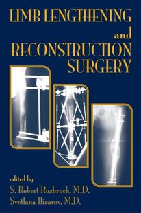 【预订】Limb Lengthening and Reconstruction Surgery