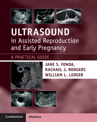 【预订】Ultrasound in Assisted Reproduction and Early Pregnancy