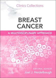 Multidisciplinary 预订 Cancer Approach Breast