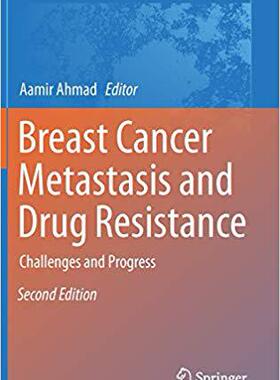 【预售】Breast Cancer Metastasis and Drug Resistance: Challenges and Progress