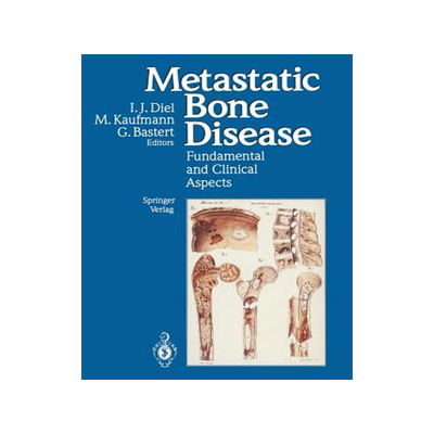 预订 Metastatic Bone Disease