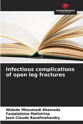 [预订]Infectious complications of open leg fractures 9786205810224