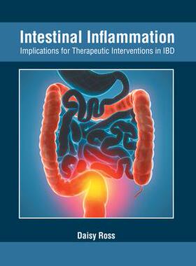 [预订]Intestinal Inflammation: Implications for Therapeutic Interventions in Ibd 9781632429599