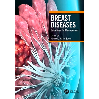 预订 Breast Diseases: Guidelines for Management
