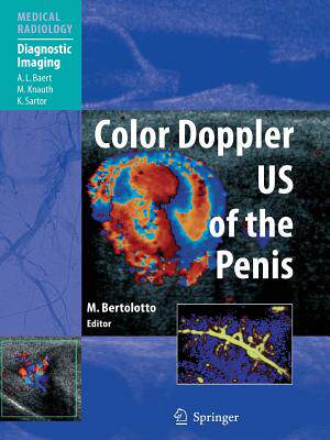 【预订】Color Doppler US of the Penis