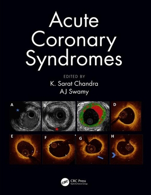 【预订】Acute Coronary Syndromes