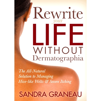 预订 Rewrite Your Life Without Dermatographia: The All-Natural Solution to Managing Hive-like Welts and Severe Itching: