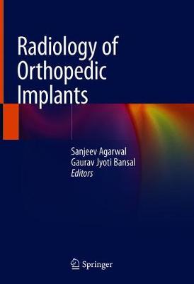 【预订】Radiology of Orthopedic Implants
