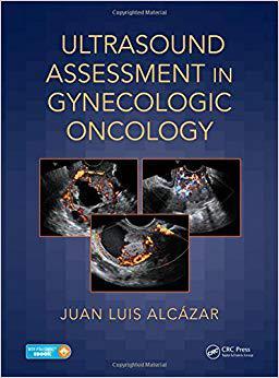 【预订】Ultrasound Assessment in Gynecologic Oncology