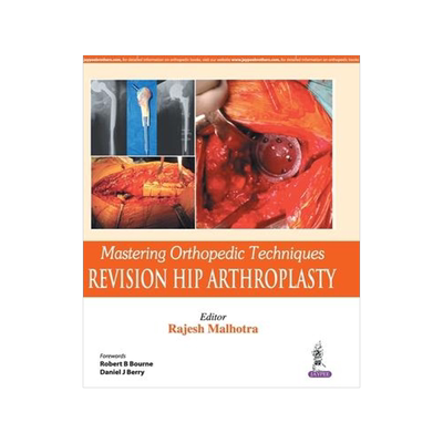 [预订]Mastering Orthopedic Techniques- Revision Hip Arthroplasty 9789351524861