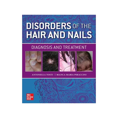 [预订]Disorders of the Hair and Nail: Diagnosis and Treatment 9781260462470