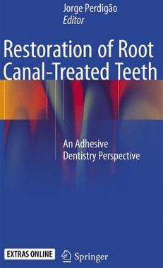 预订 Restoration of Root Canal-Treated Teeth