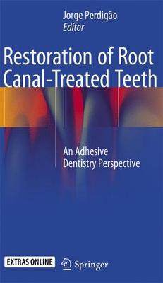 预订 Restoration of Root Canal-Treated Teeth