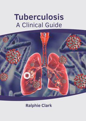 [预订]Tuberculosis: A Clinical Guide 9781639875429