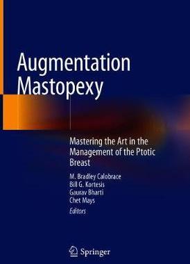 【预订】Augmentation Mastopexy
