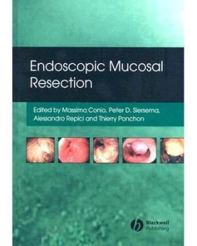 预订 Endoscopic Mucosal Resection 内窥镜黏膜切除术: 9781405158855