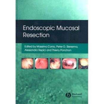 预订 Endoscopic Mucosal Resection 内窥镜黏膜切除术: 9781405158855
