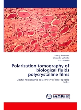预订 Polarization tomography of biological fluids polycrystalline films: 9783659895579