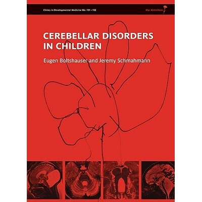 预订 Cerebellar Disorders In Children 儿童小脑疾病 (丛书) 9781907655012