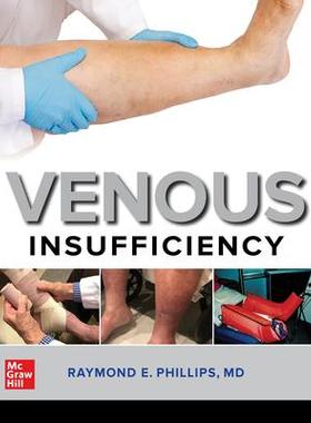 [预订]Venous Insufficiency 9781260461268