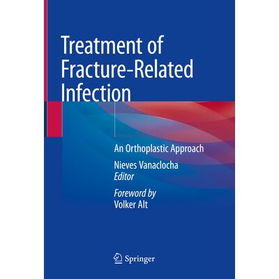 预订 Treatment of Fracture-Related Infection: An Orthoplastic Approach 骨折相关感染的治疗：正畸性方法: 9783031924514