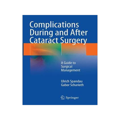 预订 Complications During and After Cataract Surgery