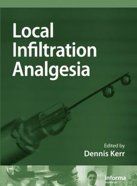 【预订】Local Infiltration Analgesia