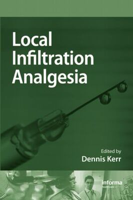 【预订】Local Infiltration Analgesia