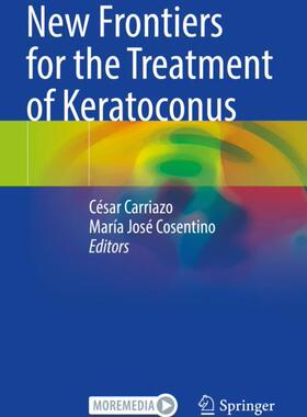 【预订】New Frontiers for the Treatment of Keratoconus 9783030661458