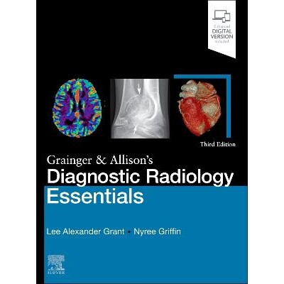 预订 Grainger & Allison’s Diagnostic Radiology Essentials Grainger & Allison 的《诊断放射学要点》 9780323936057