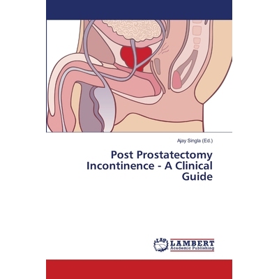 预订 Post Prostatectomy Incontinence - A Clinical Guide: 9783659449505