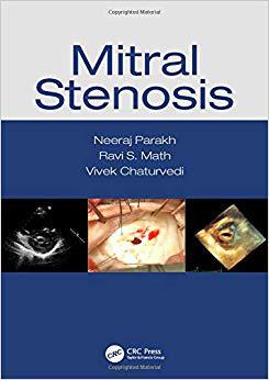【预订】Mitral Stenosis