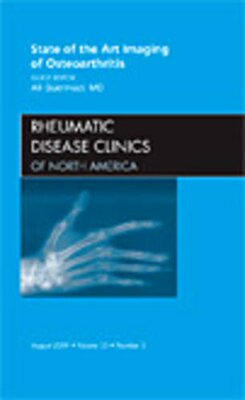 【预订】State of the Art Imaging of Osteoarthritis, An Issue of Rheumatic Disease Clinics