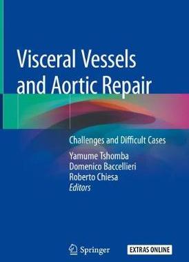 【预订】Visceral Vessels and Aortic Repair