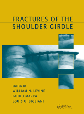 【预订】Fractures of the Shoulder Girdle