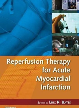 【预订】Reperfusion Therapy for Acute Myocardial Infarction
