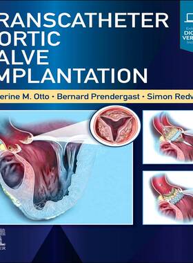 [预订]Transcatheter Aortic Valve Implantation