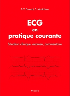 预订 ECG en pratique courante : situation clinique, examen, commentaire 日常实践中的心电图：临床情况、检查、评论: 978222