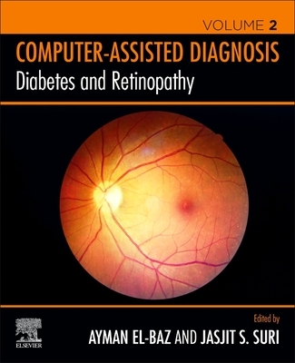 【预订】Diabetes and Retinopathy