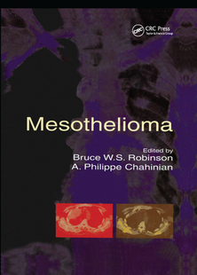 【预订】Mesothelioma