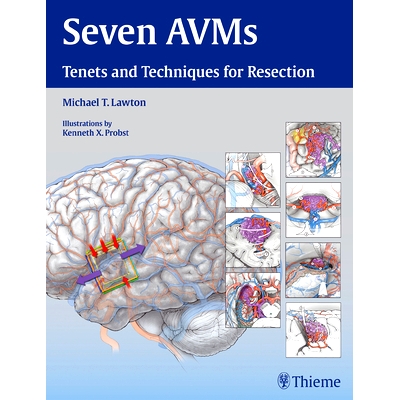 Tenets and Techniques for Resection