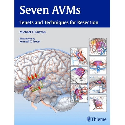 预订 Seven AVMs: Tenets and Techniques for Resection 七动静脉畸形: 9781604068757