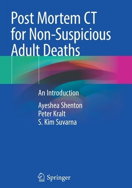 【预订】Post Mortem CT for Non-Suspicious Adult Deaths 9783030708313