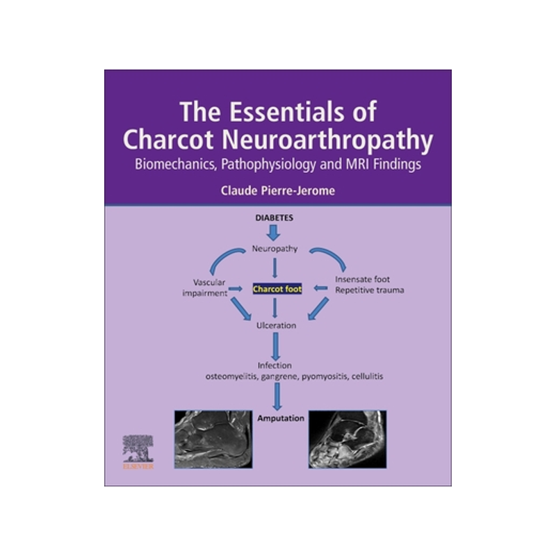 [预订]The Essentials of Charcot Neuroarthropathy