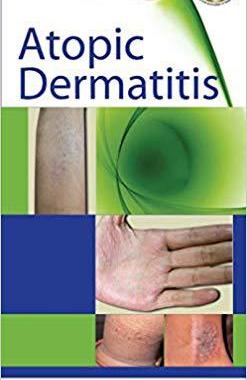 【预售】Atopic Dermatitis