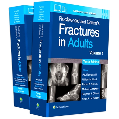 预订 Rockwood and Green’s Fractures in Adults: Print + eBook with Multimedia Rockwood & Wilkins成人骨折: 9781975211608