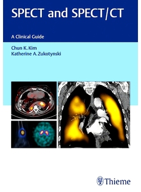 预订 SPECT and SPECT/CT: A Clinical Guide SPECT 和 SPECT/CT: 9781626231511