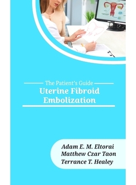 预订 Uterine Fibroid Embolization: 9781946665294