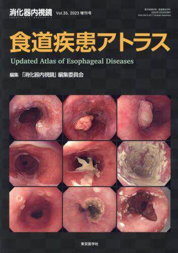 国外库房发货，通常付款后5-8周到货！