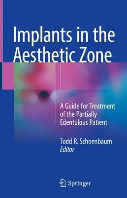 【预订】Implants in the Aesthetic Zone